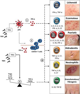 Paradoxical Skin Reactions to Biologics in Patients With Rheumatologic Disorders